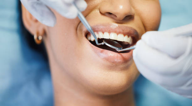 Best Emergency Dentist for Knocked-Out Tooth in Alum Rock, CA